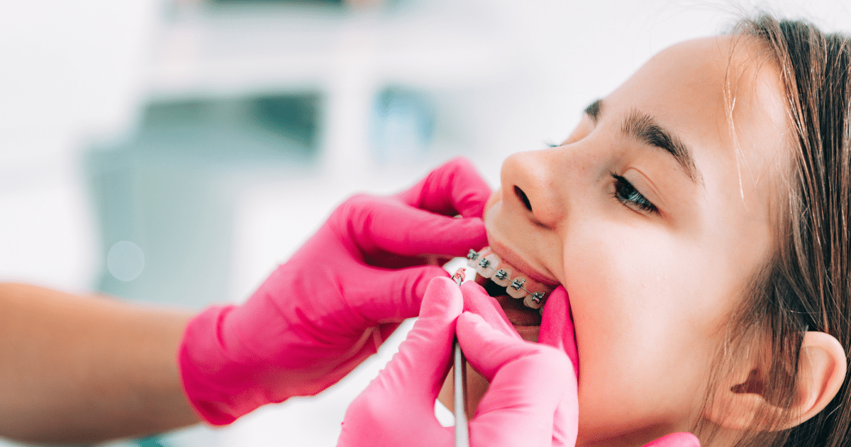 When to Consider Orthodontics for Your Child Signs and Benefits